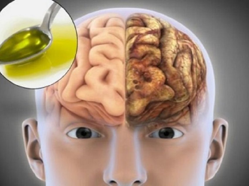 health-benefits-of-olive-oil