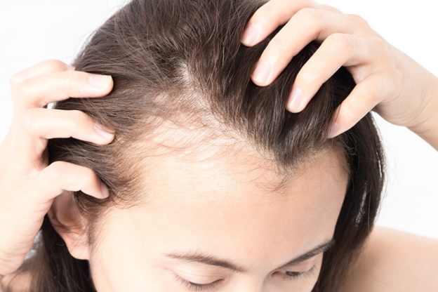 can-dry-shampoo-cause-hair-loss